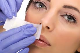 Excessive or unwanted hair that grows on a woman's body and face is the result of a condition called hirsutism. Facial Fuzz Causes Treatments Lionesse Beauty Bar