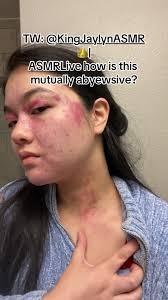 King Jaylyn ASMR Live Allegations: How is This Mutually Abusive?