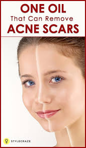 Pin On Skincare Hair