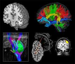 L'indiscussa professionalità e la lunga esperienza lavorativa nella. Fondazione Irccs Istituto Neurologico Carlo Besta Rin