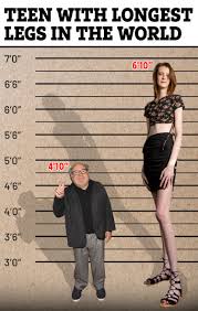 I have the world's longest legs that are almost same height as Danny DeVito  - I have OnlyFans at 19 for specific reason | The US Sun