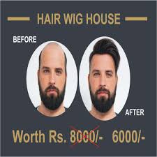 Contact hair salons near me on messenger. Kakas Men S Hair Patch Kakas Hair And Beauty Salon