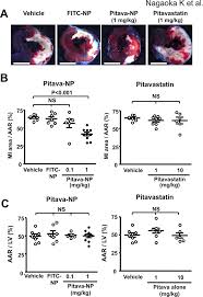 Effects Of Pitavastatin Np On Mi Size A Representative