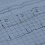 New AI Innovations Revolutionize Heart and Brain Health Monitoring