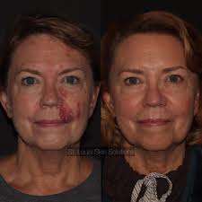 TOP 10 BEST Health & Beauty near Soulard, Saint Louis, MO