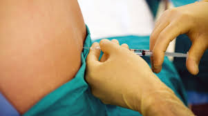 Image result for Active Labor Anesthesia