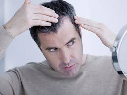 Rambut gugur kerap pasti dialami semua orang setiap hari. Lambat Sarapan Salah Satu Daripada 5 Punca Lelaki Cepat Botak Walau Masih Muda Mode Mstar