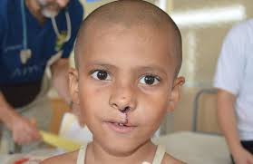 Rotaplast Missions: 2014 Sylhet, Bangladesh