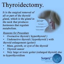Pin On About Surgeries And Diseases
