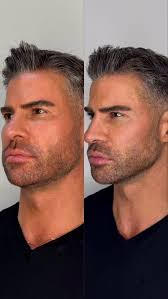 Come join my experience with @enhancedbyren , Just leveled up my look with  a jawline enhancement 💉✨ Subtle, sculpted, and so worth it., #JawlineGoals  #FacialContouring #SelfCareGlow #enhancedbyren ...