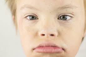 187 Downs Eye Stock Photos