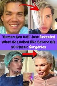 Human Ken Doll Just Revealed What He Looked Like Before His 58 Plastic Surgeries Plastic Surgery Celebrity Surgery Eye Makeup Techniques