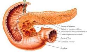 Resultado de imagen de fibrosis quistica de pancreas