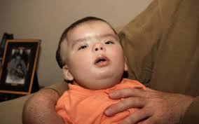 Even with Insurance, Family of Medically Fragile Child Struggles to Find  Home Health Care