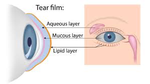 Book magnolia hotel dallas downtown, dallas on tripadvisor: Dry Eye Part 1 What Is Dry Eye Oodo Optical