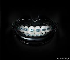 Black And White Braces Brace Face Brace Face Lip Art Inspiration