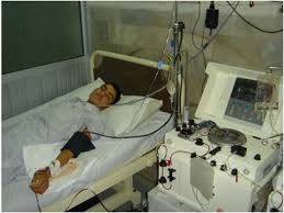 Surprisingly, unlike most other things you hear about vaccines from folks like sherri tenpenny, the idea that some covid vaccines might be associated with gbs might be true. Mexiko Behorden Bestatigten Ausbruch Des Guillain Barre Syndrom Latinapress Nachrichten