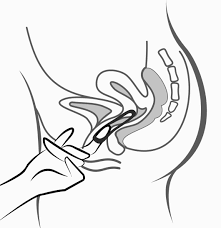 sp.zn.sukls274938/2018 Příbalová informace: informace pro uživatelku Setlona 0,120 mg/0,015 mg za 24 hodin vaginální inzer