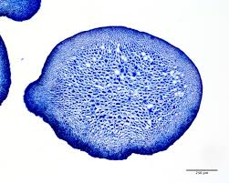 Image result for Microcoelia physophora