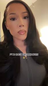 Mia Aesthetics Baltimore and After