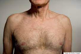 A cancerous lump may feel rounded, soft, and tender and can occur anywhere in the breast. 6 Things Men Affected By Breast Cancer Want You To Know Huffpost Uk Life