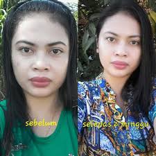 testimoni glow glowing skincare