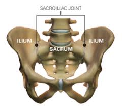 Image result for Sacroiliac Dysfunction