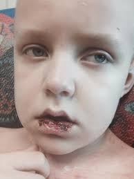 I M Not As Strong As You Think A Cancer Moms Confession Saving U Green Cancer Kids Childhood Cancer Awareness Month Childhood Cancer
