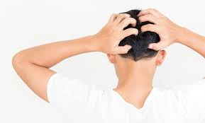 kopfhaut pilz wenn der kopf juckt die haare ausfallen haarausfall hilfe haarausfall haare haarausfall frauen