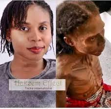 VlH transformé en autre chose au bout de quelques années😭😭😭😭.Angelina  Josiane depuis l'Allemagne .J'ai toujours maintenu ma forme initiale au  début. Seulement un petit matin la maladie a déclenché 😭.Ma peau a