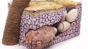 علاج الجرب بالأدوية والعلاجات الطبيعية والمنزلية. Scabies Ø§Ù„Ø¬Ø±Ø¨ Youtube