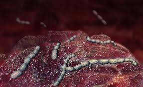 La scarlattina è una delle malattie esantematiche più note.a differenza delle altre, però, è causata non da un virus, bensì da un batterio, lo streptococco beta emolitico di gruppo a.come tutte le malattie esantematiche, la scarlattina colpisce maggiormente i bambini. Scarlattina In Adulti E Bambini I Sintomi E La Durata Pazienti It