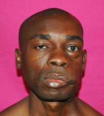 Earthwide Surgical Foundation: 2014