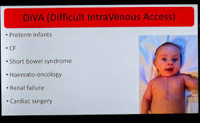 Image result for Difficult Intravenous Access in Children