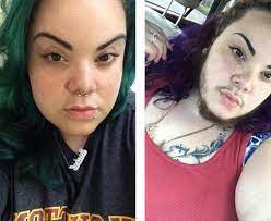 Pcos causes hair to fall out from the head due to hormonal imbalances. Women With Pcos Explain Why They Celebrate Their Facial Hair Allure