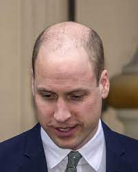 Der prinz hat die haare schön. Prinz William Hat Das Problem Vieler Manner Die Haare Werden Weniger