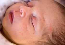 Thankfully, there are a number of easy tips you can employ to find the best skincare center in your area (rather than just googling skin care clinic near me and hoping. Newborn Skin 101 Johns Hopkins Medicine