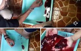 Organ tubuh yang mengalami infeksi kuman penyakit dapat sembuh secara automatik kerana tubuh memproduksi. Al Fashdu Berpetik