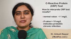 C Reactive Protein Crp Blood Test