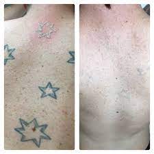 Cross tattoos are one of the most popular tattoo designs for guys. Changing Beliefs In Symbolism A Study Of Southern Cross Tattoos Renude Laser