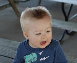 Down Syndrome