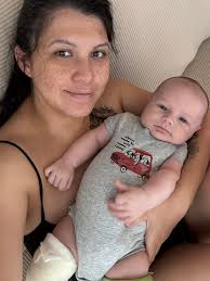 Why does diaper rash persist with new diapers?