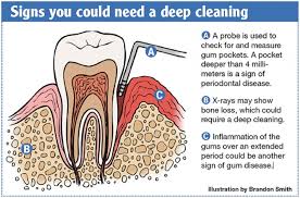 Find out if a dental savings plans from dentalplans.com can save you money on your next dental procedure. How Much Does A Teeth Cleaning Cost Teethwalls