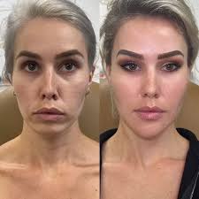 AR Aesthetics St. Petersburg: See Client Testimonials