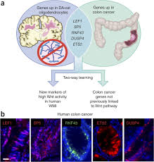 There may be mucous or brightly colored, red blood in your cat's feces. Parallel States Of Pathological Wnt Signaling In Neonatal Brain Injury And Colon Cancer Nature Neuroscience