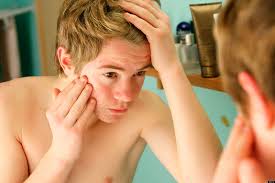 Acne Adolescente Cosmetologia Uba