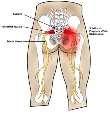 Pin On Exercise And Health
