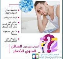 ‫أسباب تغير لون السائل المنوي للأصفر أحيانًا قد يكون اللون ...‬‎