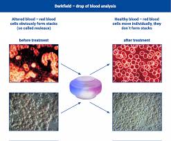 What do you need to know about structured water? Structured Water What Effect Can It Have Bicomuk