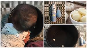 Petua hilangkan selsema ini mungkin agak sukar untuk dilakukan kerana biasanya apabila selsema, selera makan juga. Cara Hilangkan Selsema Bayi Hidung Tersumbat Dengan Kaedah Stim Bawang Putih